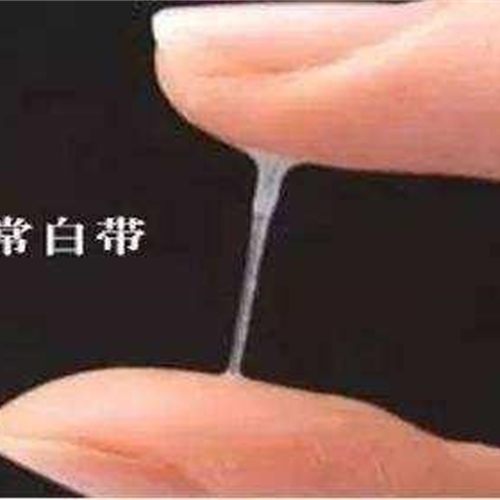 女人為什么會(huì)有白帶